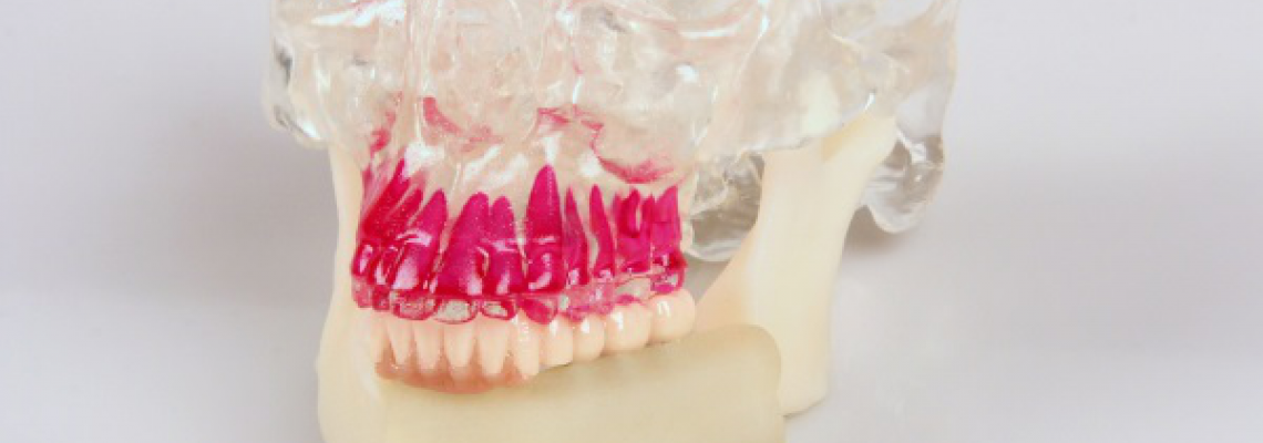 3D печать в виртуальном планировании: проект «Jaw in a Day» от 3D Systems 3D печать в виртуальном планировании: проект «Jaw in a Day» от 3D Systems