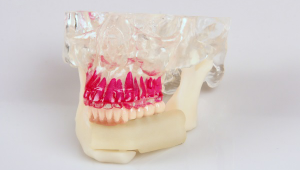 3D печать в виртуальном планировании: проект «Jaw in a Day» от 3D Systems
