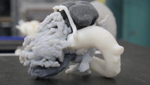 Компания GE Healthcare упростит перевод данных КТ-сканирования в 3D модели в медицине
