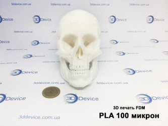 FDM 3D printed human skull model from PLA plastic. Anatomical and educational replica service by 3DDevice experts.