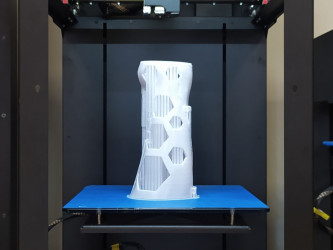 3D printed custom orthosis, an orthopaedic medical device