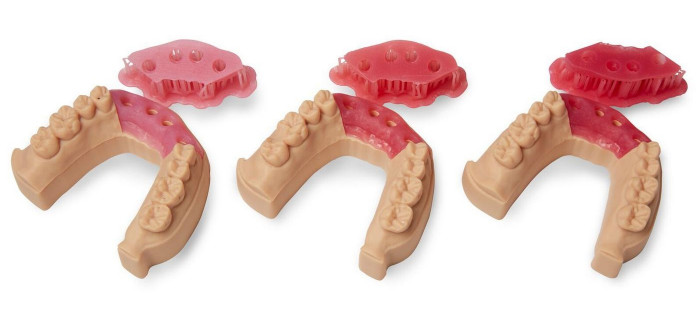SLA 3D-печать в стоматологии: Soft Tissue Kit с пигментами для печати цветных частей мягких тканей пациента