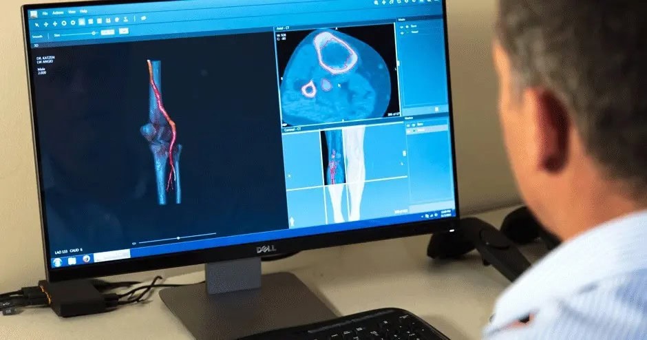 3D печать анатомической модели в несколько простых шагов