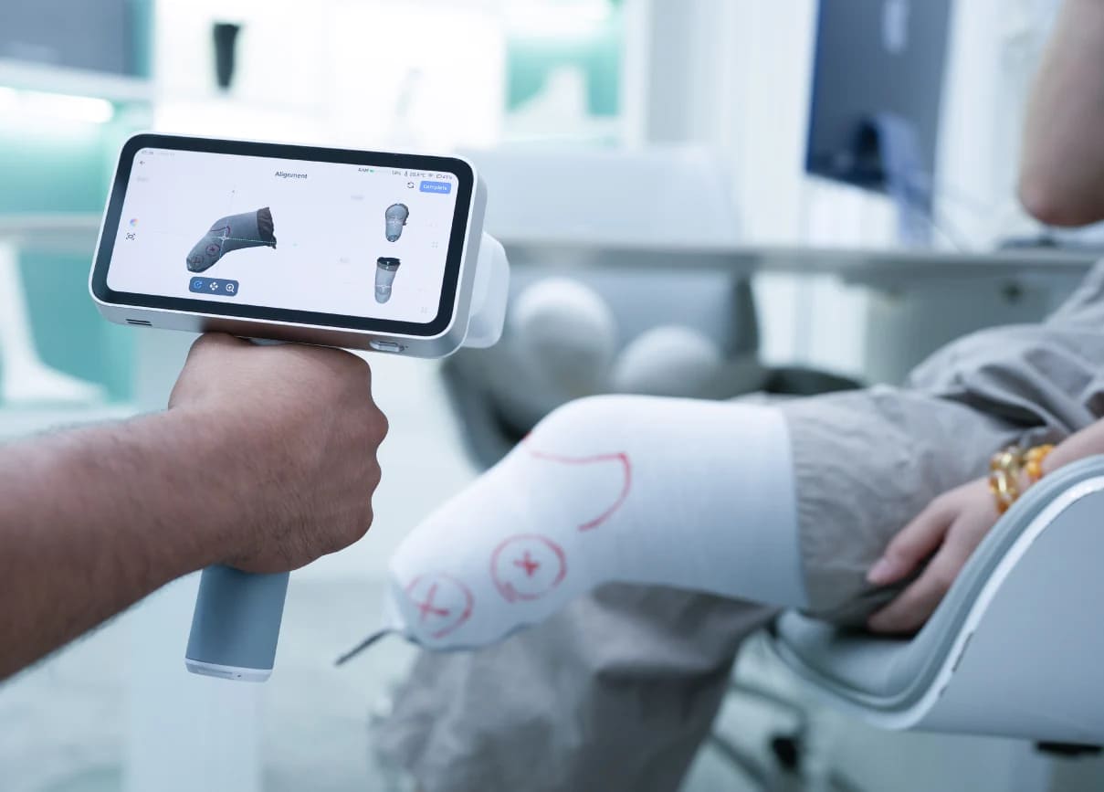 Протезирование конечностей