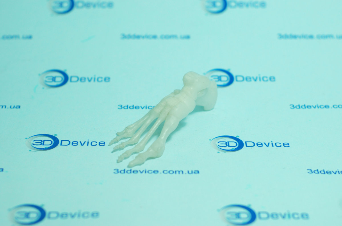 3D макет костей стопы, напечатанный на 3D принтере