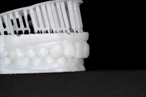 Фотополимерная смола Formlabs White Resin в стоматологии