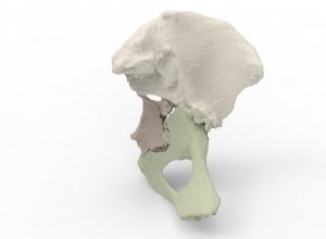 Кости таза 3D сканирование
