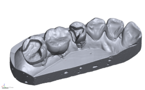 3D сканер зубов в Украине