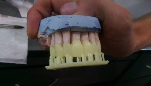 Зуби Formlabs Form 2