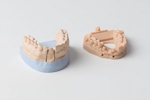 Применение Formlabs Dental Model Resin в стоматологии