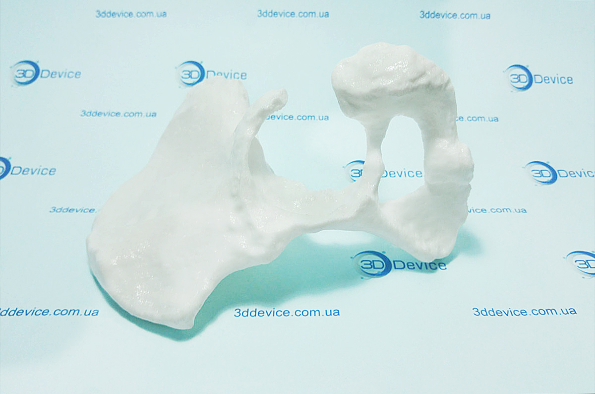 3D-печать-костей-на-основе-данных-КТ-сканирования
