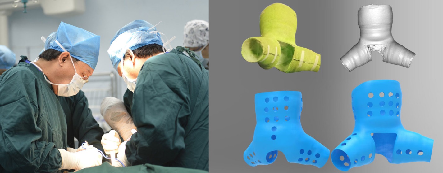  Hand-held 3D scanner for medicine